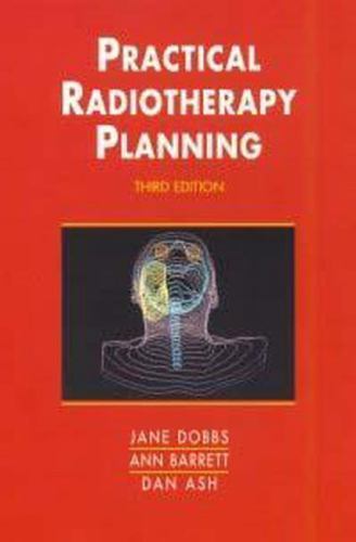 Practical Radiotherapy Planning