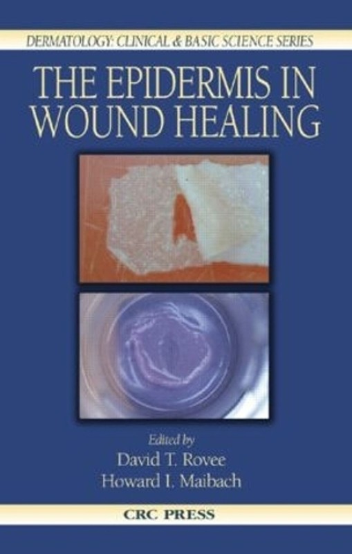 The Epidermis in Wound Healing by David T. Rovee (English) Hardcover Book