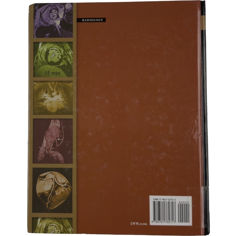 MRI and CT of the Cardiovascular System (Second Edition) - Higgins & de Roos gallery