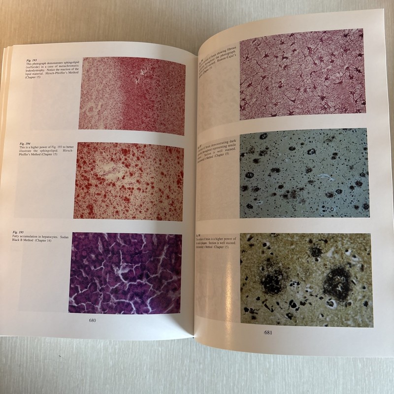 Histopathologic Methods & Color Atlas of Stains Tissue Artifacts Lee G Luna 1992 gallery