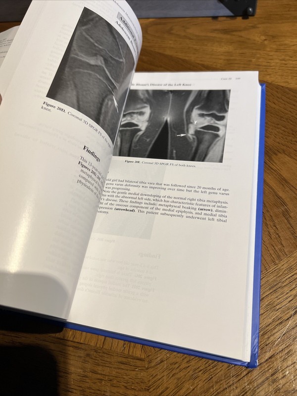 PEDIATRIC AND ADOLESCENT MUSCULOSKELETAL MRI: A CASE-BASED By J. Herman Kan gallery