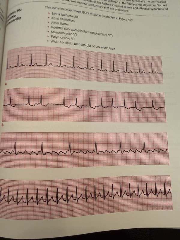 Advanced Cardiovascular Life Support Provider Manual by AHA USED CONDITION gallery