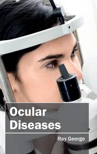Ocular Diseases (Hardback)