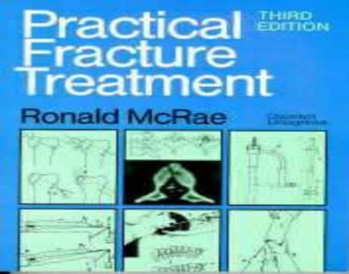Practical Fracture Treatment – GOOD