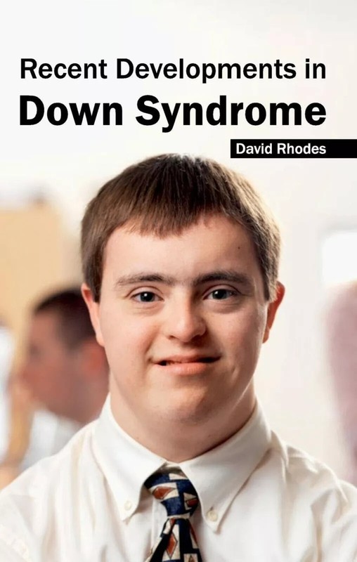 “Recent Developments in Down Syndrome” David Rhodes (Hardback) Free US Shipping