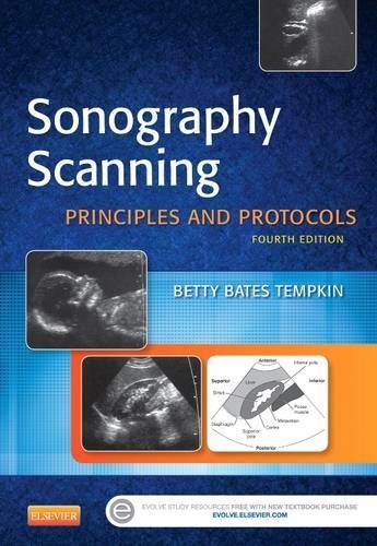 Sonography Scanning: Principles and…, Tempkin BA, Bet