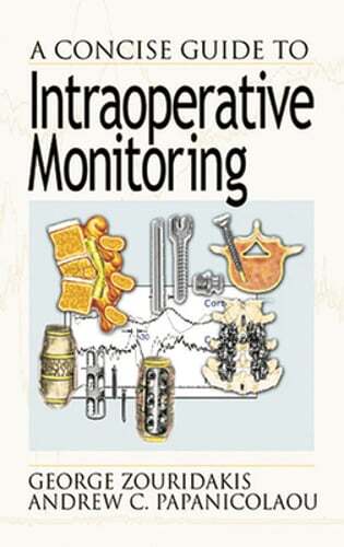 A Concise Guide to Intraoperative Monitoring by George Zouridakis: New