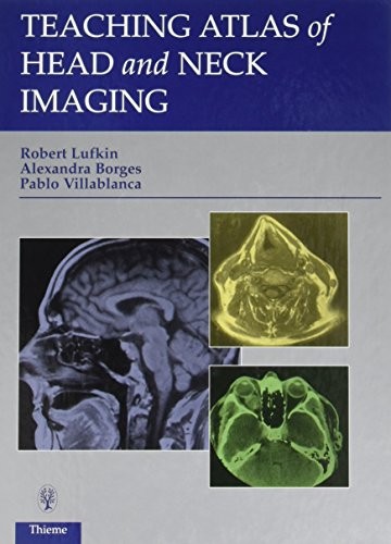 TEACHING ATLAS OF HEAD AND NECK IMAGING By Robert B. Lufkin & Alexandra Borges