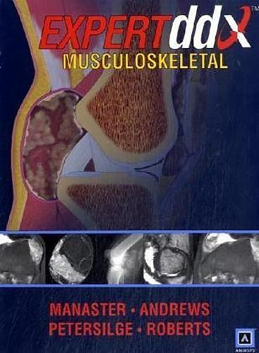 Expertddx: Musculoskeleta