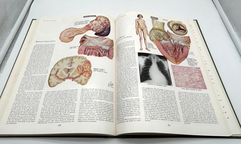 CIBA Collection of Medical Illustrations, Volume 5: Heart, by Frank Netter 1971 gallery