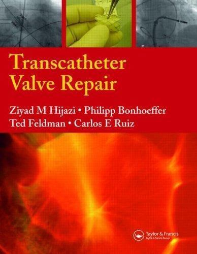 Transcatheter Valve Repair, Hardcover by Hijazi, Ziyad M. (EDT); Bonhoeffer, …