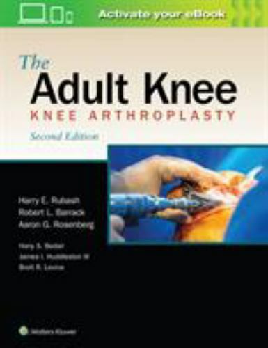 The Adult Knee: 9781975114688: Medicine & Health Science Books
