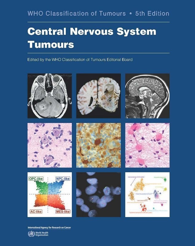 Central Nervous System Tumours Paperback USA STOCK gallery
