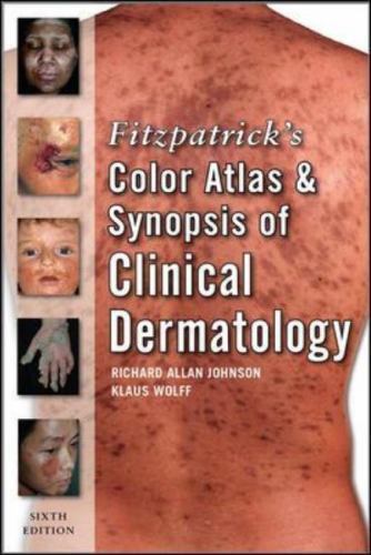 Fitzpatrick’s Color Atlas and Synopsis of Clinical Dermatology: Sixth Edition