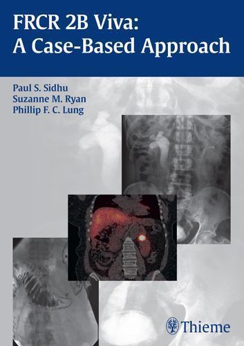 FRCR 2B Viva : A Case-Based Approach, Paperback by Sidhu, Paul S.; Ryan, Suza…