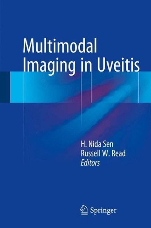 Multimodal Imaging in Uveitis by H. Nida Sen (English) Hardcover Book