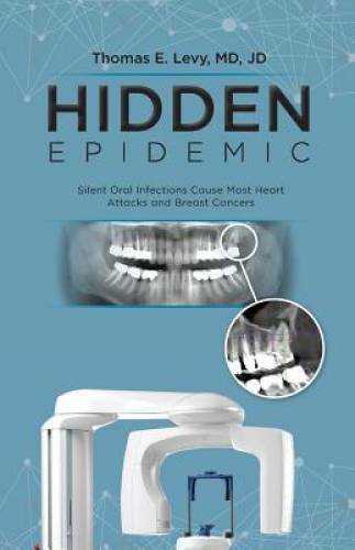 Hidden Epidemic: Silent Oral Infections Cause Most Heart Attacks and Brea – GOOD