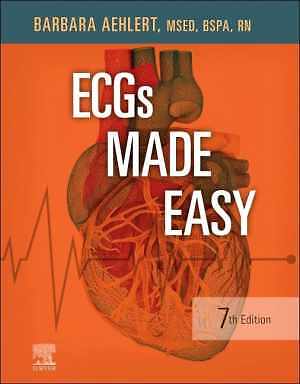 ECGs Made Easy – Paperback, by Aehlert MSEd BSPA RN Barbara J – Good o