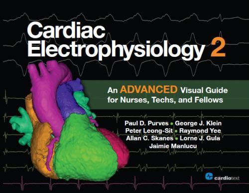 Cardiac Electrophysiology 2: An Advanced Visual Guide for Nurses, Techs, and Fel