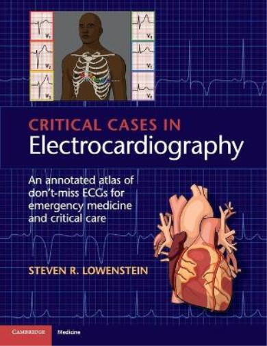 Steven R. Lowenstei Critical Cases in Electrocardiograph (Paperback) (UK IMPORT)