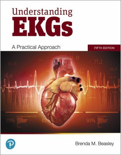 Understanding EKGs: A Practical Approach, Beasley, Brenda, Book