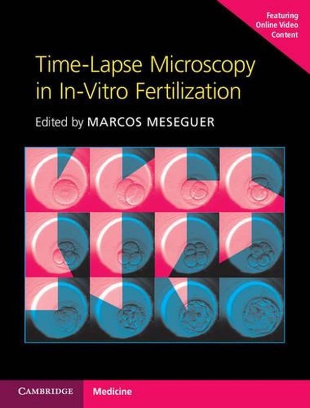 Time-Lapse Microscopy in In-Vitro Fertilization Hardback with Online Resource by