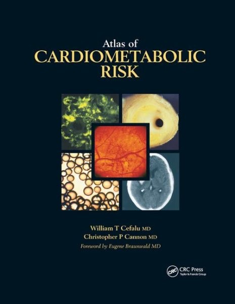 Atlas of Cardiometabolic Risk, Paperback by Cefalu, William T.; Cannon, Chris…