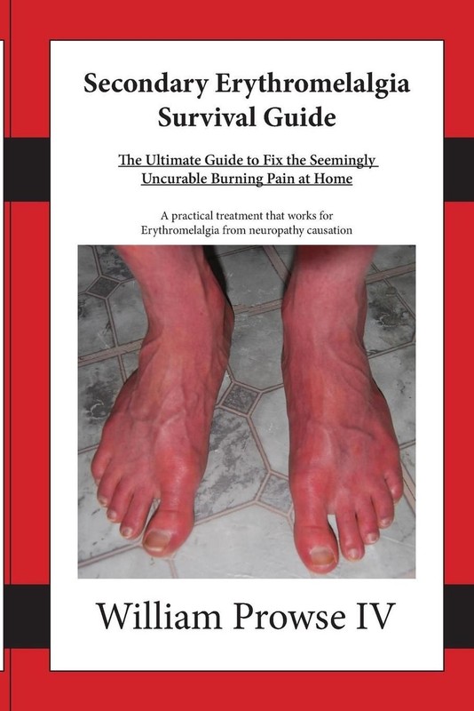 Secondary Erythromelalgia Survival Guide by William E. Prowse IV (English) Paper