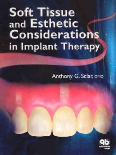 Soft Tissue and Esthetic Considerations in Implant Dentistry By Anthony G. Sclar