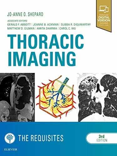 Thoracic Imaging The Requisites – Hardcover, by Shepard MD Jo-Anne – Very Good v
