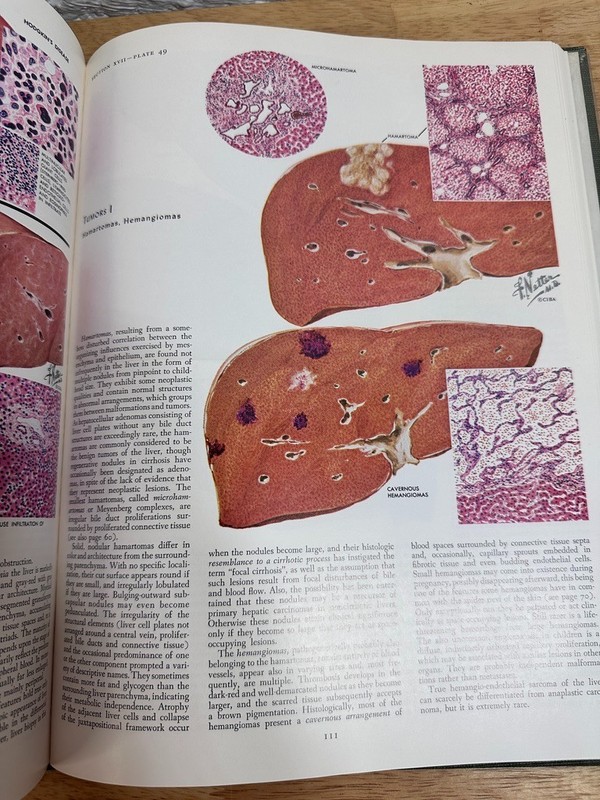 The CIBA Collection Of Medical Illustrations Volume 3 Digestive System 1964 gallery