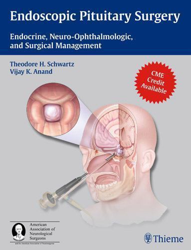Endoscopic Pituitary Surgery : Endocrine, Neuro-Ophthalmologic… HARDBACK