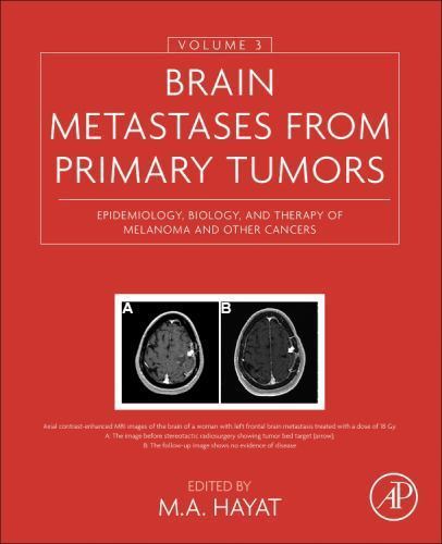 Brain Metastases from Primary Tumors : Epidemiology, Biology, and Therapy of …