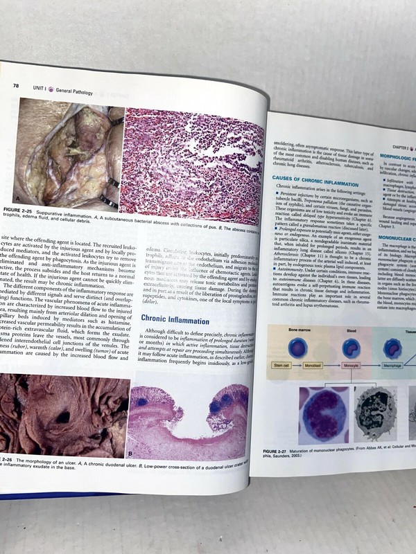 Robbins & Cotran Pathologic Basis of Disease, Seventh Edition WITH CD gallery
