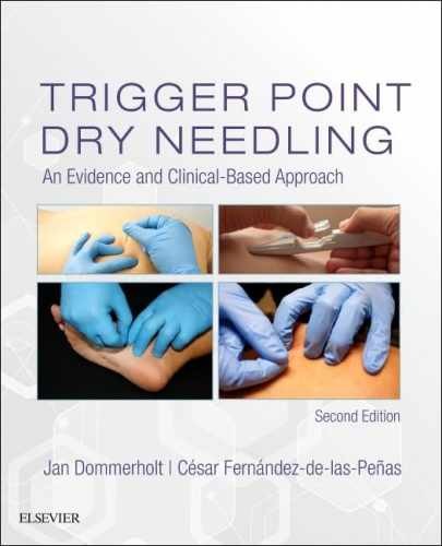 Trigger Point Dry Needling: An – Hardcover, by Dommerholt PT DPT – Very Good