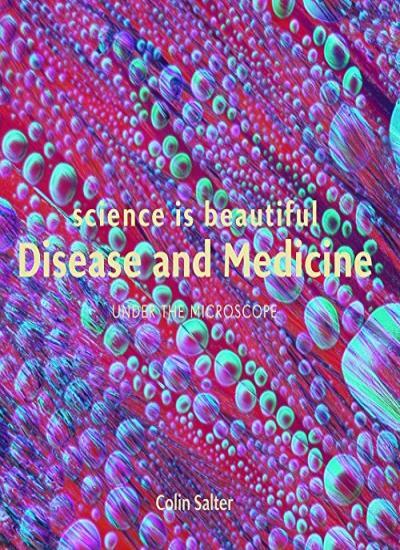 Science Is Beautiful Disease and Medicin, Salter 9781849944410 Free Shipping..