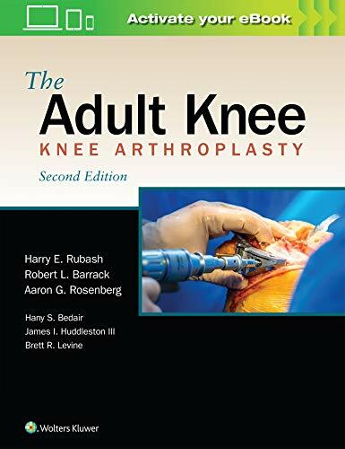 The Adult Knee by Rubash New 9781975114688 Fast Free Shipping.+
