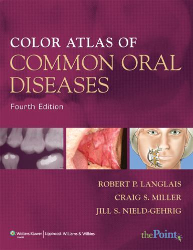 COLOR ATLAS OF COMMON ORAL DISEASES 4E: . – paperback, Langlais, 9780781780971