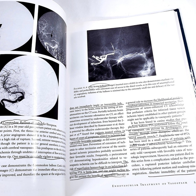 Springer Interventional Endovascular Therapy Nervous System Pearse Morris SZ VTG gallery