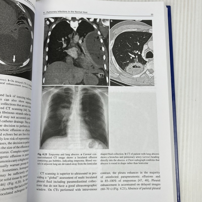 Clinically Oriented Pulmonary Imaging by Jeffrey Kanne Respiratory Medicine HC gallery