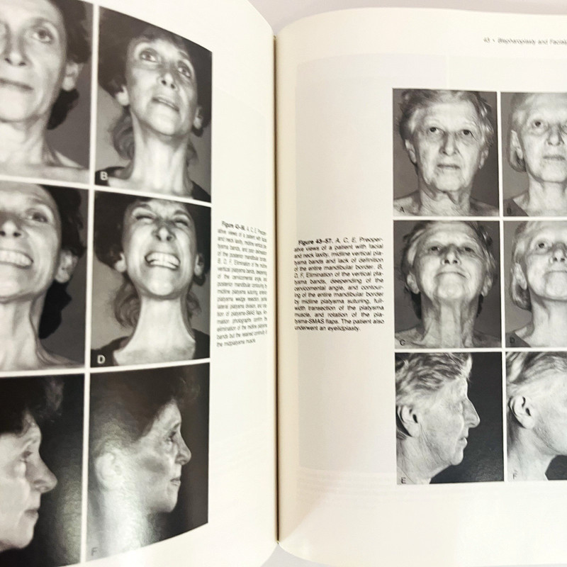 Vintage Plastic Surgery Vol 3 The Face Part 2 Book Hardcover McCarthy 1990 gallery