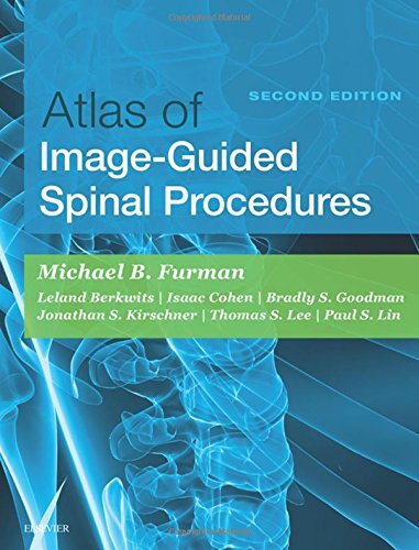 Atlas of Image-Guided Spinal Procedures by Michael Bruce Furman
