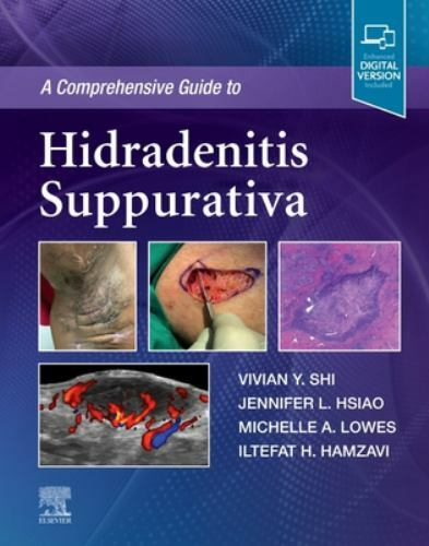 Comprehensive Guide to Hidradenitis Suppurativa, Hardcover by Shi, Vivian Y.;…