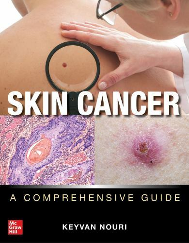 Skin Cancer : A Comprehensive Guide, Hardcover by Nouri, Keyvan, Brand New, F…