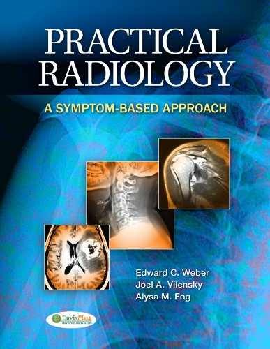Practical Radiology: A – Paperback, by Weber Edward C.; – Very Good