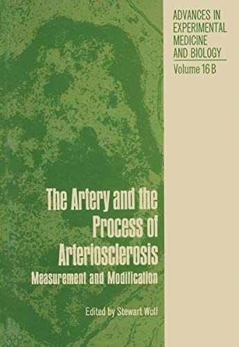 The Artery and the Process of – Paperback, by Wolf Stewart – Very Good