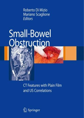 Small-Bowel Obstruction : CT Features with Plain Film and US Correlations by…