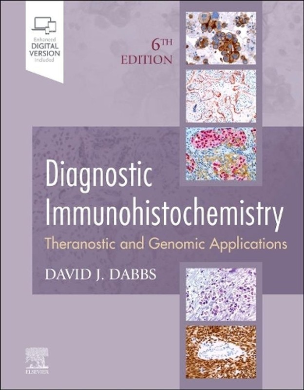 Diagnostic Immunohistochemistry: Theranostic and Genomic Applications by David J