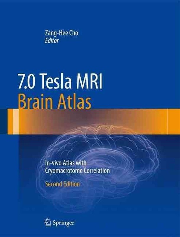 7.0 Tesla MRI Brain Atlas: In-vivo Atlas with Cryomacrotome Correlation by Zang-