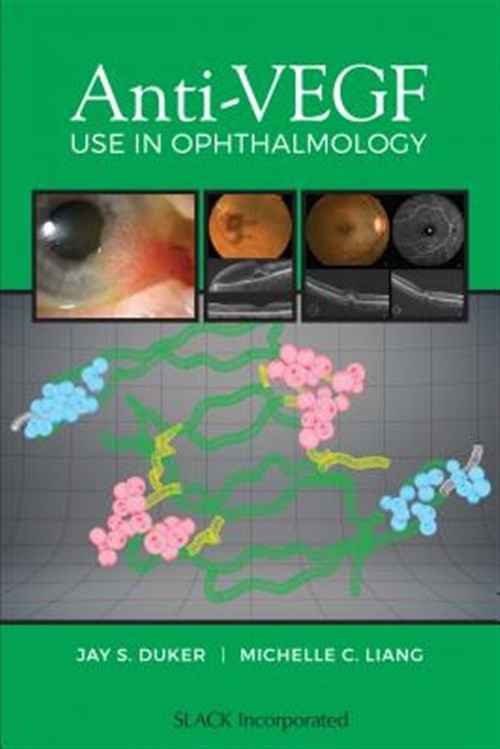 Anti-VEGF Use in Ophthalmology, Paperback by Duker, Jay S., M.D. (EDT); Liang…